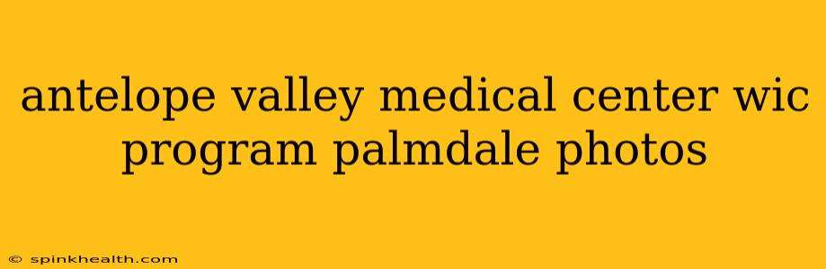 antelope valley medical center wic program palmdale photos