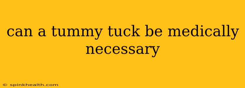 can a tummy tuck be medically necessary