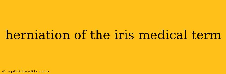 herniation of the iris medical term