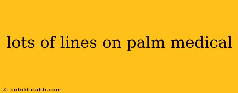 lots of lines on palm medical
