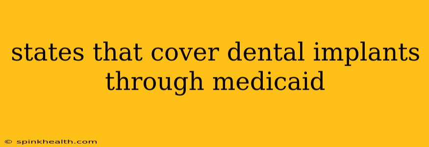 states that cover dental implants through medicaid