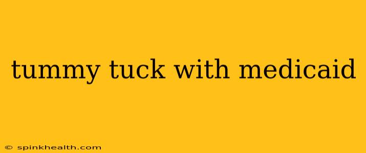 tummy tuck with medicaid