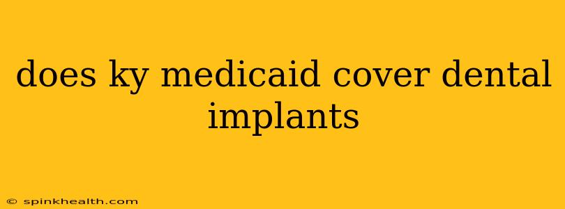 does ky medicaid cover dental implants