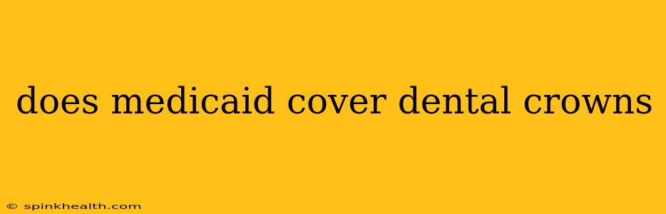 does medicaid cover dental crowns