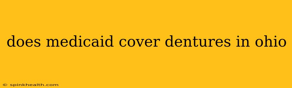 does medicaid cover dentures in ohio