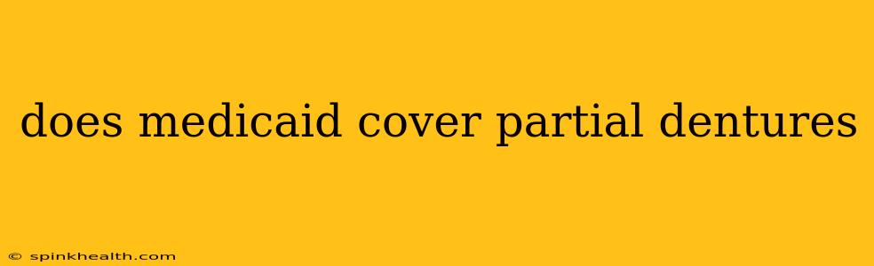 does medicaid cover partial dentures