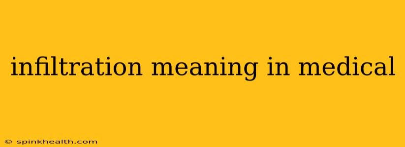 infiltration meaning in medical