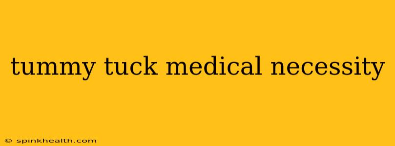 tummy tuck medical necessity