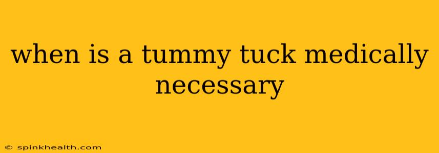 when is a tummy tuck medically necessary